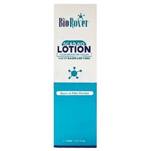 Biorover Scab-No Lotion Uyuz Losyonu Etkin Formül 150 ml