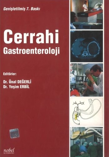 Cerrahi Gastroenteroloji